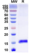 SDS-PAGE for Anti-Human CCT5 Nanobody (SAA1374).