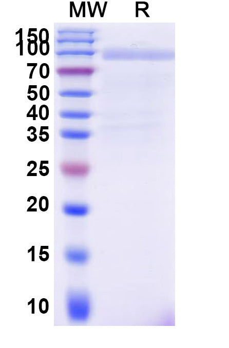 Recombinant Human CD97/ADGRE5 Protein, C-Fc