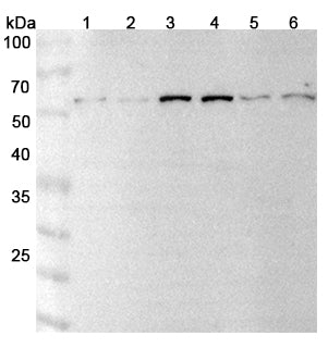 Western blot analysis was performed using anti-ECE1 polyclonal antibody at 1μg/ml on various samples.
Lane 1: A549 cell lysate
Lane 2: HUVEC cell lysate
Lane 3: NIH3T3 cell lysate
Lane 4: Jurkat cell lysate
Lane 5: H1299 cell lysate