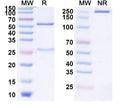 Anti-Human CD200&MOX1 Reference Antibody (Samalizumab) – Figure 1 of 1