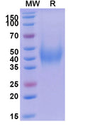 Recombinant Human CD200 Protein, C-His