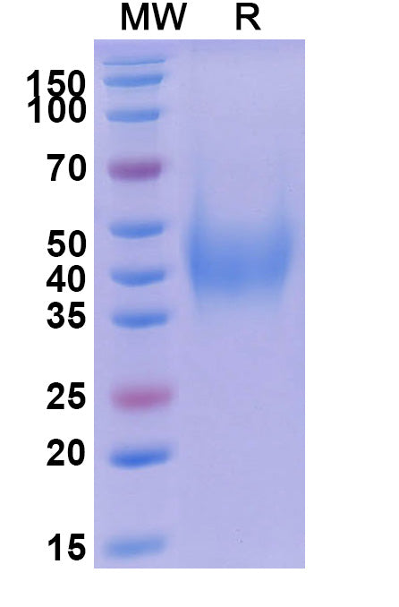 Recombinant Human CD200 Protein, C-His