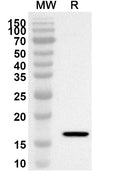 Western blot analysis was performed using anti-RBP2 polyclonal antibody at 1ug/mL on recombinant RBP2 (Catalog No. HW742012).