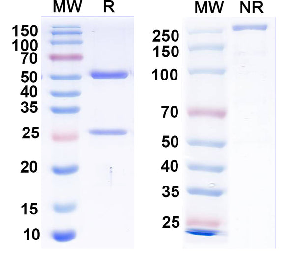 SDS-PAGE for Anti-Clcn5 Antibody (N406/48)