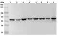 Western blot analysis was performed using anti-MAP2K4 polyclonal antibody at 1μg/ml on various samples.
Lane 1: RAW264.7 cell lysate
Lane 2: NIH3T3 cell lysate
Lane 3: 293T cell lysate
Lane 4: HepG2 cell lysate
Lane 5: Jurkat cell lysate
Lane 6: K562 cell lysate
Lane 7: PC-12 cell lysate
Lane 8: Mouse brain lysate