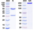 SDS-PAGE for Anti-Human SNCA/Alpha-synuclein Antibody (D10)