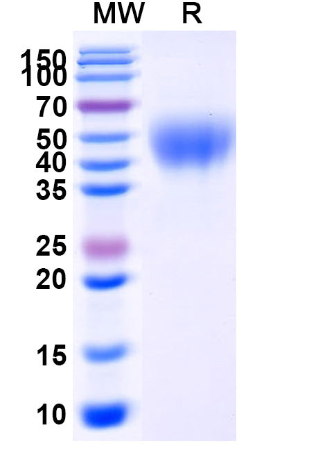 Recombinant Human CD158a/KIR2DL1 Protein, C-His