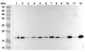 Western blot analysis was performed using anti-RPL22 polyclonal antibody at 1ug/mL on various samples.
Lane 1: A431 cell lysate
Lane 2: Hela cell lysate
Lane 3: Jurkat cell lysate
Lane 4: U87 cell lysate
Lane 5: RAW264.7 cell lysate
Lane 6: 293T cell lysate
Lane 7: K562 cell lysate
Lane 8: PC-12 cell lysate
Lane 9: Mouse brain lysate
Lane 10: Mouse liver lysate
Lane11: Rat brain lysate
Lane12: Rat liver lysate