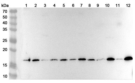 Western blot analysis was performed using anti-RPL22 polyclonal antibody at 1ug/mL on various samples.
Lane 1: A431 cell lysate
Lane 2: Hela cell lysate
Lane 3: Jurkat cell lysate
Lane 4: U87 cell lysate
Lane 5: RAW264.7 cell lysate
Lane 6: 293T cell lysate
Lane 7: K562 cell lysate
Lane 8: PC-12 cell lysate
Lane 9: Mouse brain lysate
Lane 10: Mouse liver lysate
Lane11: Rat brain lysate
Lane12: Rat liver lysate