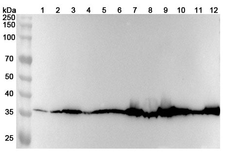 Western blot analysis was performed using anti-MDH1  polyclonal antibody at 1ug/mL on various samples.
Lane 1: Hela cell lysate
Lane 2: HepG2 cell lysate
Lane 3: HL-60 cell lysate
Lane 4: Jurkat cell lysate
Lane 5: NIH3T3 cell lysate
Lane 6: THP-1 cell lysate
Lane 7: Mouse brain lysate
Lane 8: Mouse liver lysate
Lane 9: Mouse kidney lysate
Lane 10: Rat brain lysate
Lane11: Rat liver lysate
Lane12: Rat kidney lysate