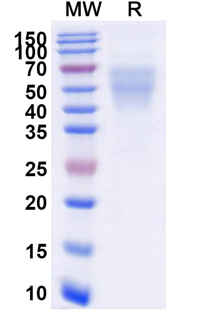 Recombinant Human CD86/B7-2 Protein, C-His
