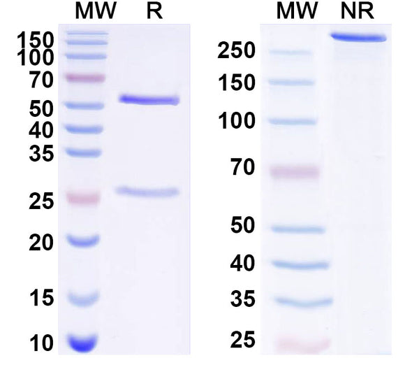 SDS-PAGE for Anti-Human CBX5 IP Antibody (SAA0260)