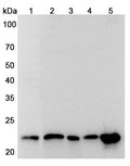 Western blot analysis was performed using anti-CBX5 polyclonal antibody at 1ug/mL  on various samples.
Lane 1: MCF-7 cell lysate
Lane 2: K562 cell lysate
Lane 3: PC-12 cell lysate
Lane 4: NIH3T3 cell lysate
Lane 5: A549 cell lysate