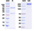 SDS-PAGE for Anti-Human CBX5 Antibody (P001)