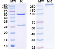 SDS-PAGE for Anti-Human ARRB1 Antibody (SAA2250)
