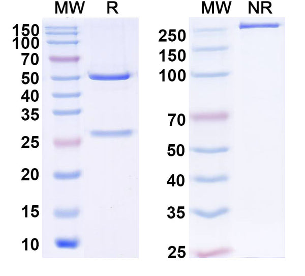 SDS-PAGE for Anti-Human ARRB1 Antibody (SAA2250)
