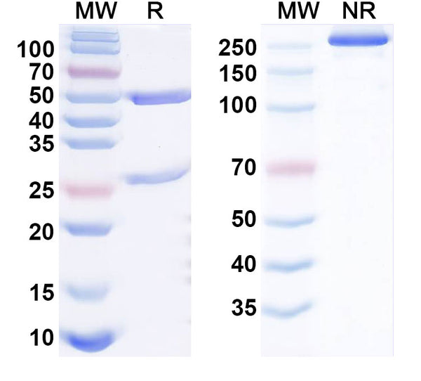 SDS-PAGE for Anti-Human KDM5C IP Antibody (SAA0206)