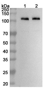 Western blot analysis was performed using anti-DPP6 polyclonal antibody at 1ug/mL on various samples.
Lane 1: Rat brain lysate
Lane 2: Rat cerebellum lysate