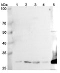 Western blot analysis was performed using anti-GCLM polyclonal antibody at 1μg/ml on various samples.
Lane 1: K562 cell lysate
Lane 2: NICH460 cell lysate
Lane 3: Mouse liver lysate
Lane 4: Mouse spleen lysate
Lane 5: Rat kidney lysate