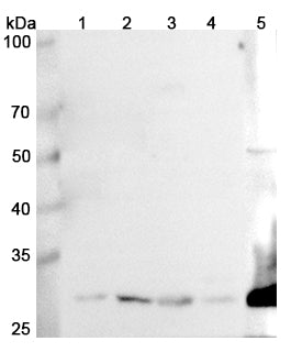 Western blot analysis was performed using anti-GCLM polyclonal antibody at 1μg/ml on various samples.
Lane 1: K562 cell lysate
Lane 2: NICH460 cell lysate
Lane 3: Mouse liver lysate
Lane 4: Mouse spleen lysate
Lane 5: Rat kidney lysate