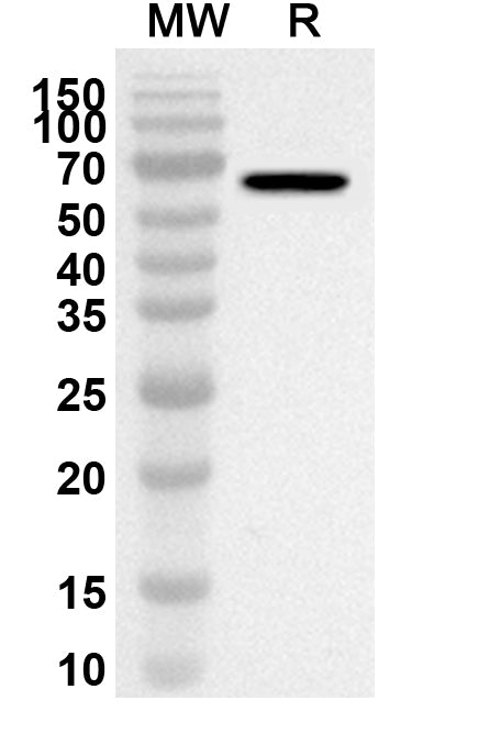 Western blot analysis was performed using anti-FBN2 polyclonal antibody at 1ug/mL on recombinant FBN2 (Catalog No. HW814012).