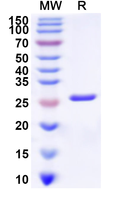 Recombinant Human PSEN2 Protein, N-His-KSI