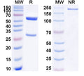 SDS-PAGE for Anti-Human PSEN2/Presenilin-2 Antibody (SAA1783)