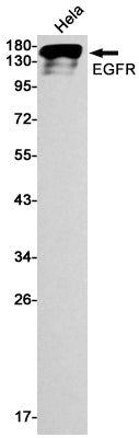 Recombinant EGFR Monoclonal Antibody – Figure 1 of 3