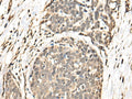 BATF Polyclonal Antibody – Figure 1 of 3