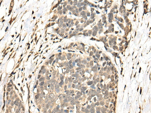BATF Polyclonal Antibody – Figure 1 of 3