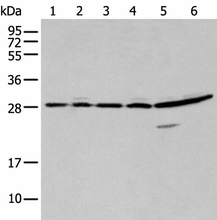 SFN Polyclonal Antibody – Figure 1 of 3