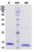 Recombinant Human IL2 Protein, C-His