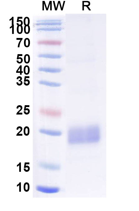 SDS-PAGE for Anti-Human ACTB/β-actin/Beta Actin Nanobody (SAA1234)