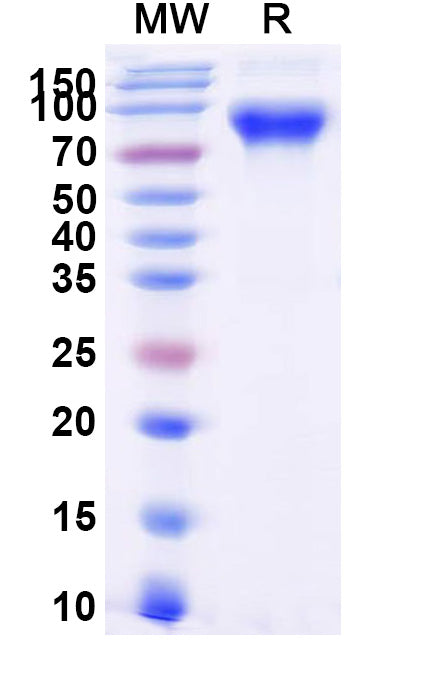 Recombinant Human CD87/PLAUR/uPAR Protein, C-Fc