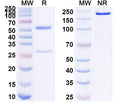 SDS-PAGE for Anti-Human CD87/PLAUR/uPAR Monoclonal Antibody (1A439)