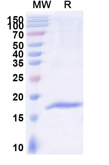 SDS-PAGE for Anti-Human CD156a/ADAM8 Nanobody (SAA1215)
