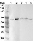 Western blot analysis was performed using anti-ADAM8 polyclonal antibody at 1ug/mL  on various samples.
Lane 1: BxPC-3 cell lysate
Lane 2: Hacat cell lysate
Lane 3: Raji cell lysate
Lane 4: THP-1 cell lysate
Lane 5: Mouse testis lysate