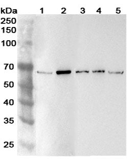 Western blot analysis was performed using anti-ADAM8 polyclonal antibody at 1ug/mL  on various samples.
Lane 1: BxPC-3 cell lysate
Lane 2: Hacat cell lysate
Lane 3: Raji cell lysate
Lane 4: THP-1 cell lysate
Lane 5: Mouse testis lysate