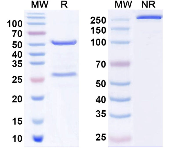SDS-PAGE for Anti-Cav1.2/1.3 Ca2+ channel Antibody (L57/23)