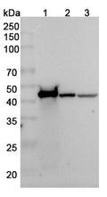Western blot analysis was performed using anti-ACTG1 polyclonal antibody at 1μg/ml on various samples.
Lane 1: recombinant human ACTG1 (Catalog No: HX058012)
Lane 2: PC12 cell lysate
Lane 3: MCF7 cell lysate
