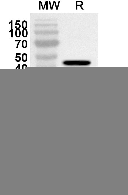 Western blot analysis was performed using anti-Human ACTR2 polyclonal antibody at 1ug/mL on recombinant Human ACTR2 (Catalog No. HX063012).