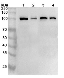 Western blot analysis was performed using anti-AP2B1 polyclonal antibody at 1ug/mL on various samples.
Lane 1: Mouse brain lysate
Lane 2: Mouse cerebellum lysate
Lane 3: Mouse brain lysate
Lane 4: Rat cerebellum lysate