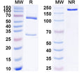SDS-PAGE for Anti-Human CAV1/Caveolin-1 Antibody (SAA1788)
