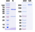 SDS-PAGE for Anti-Anti-Human DST/Dystonin antibody (SAA2231)