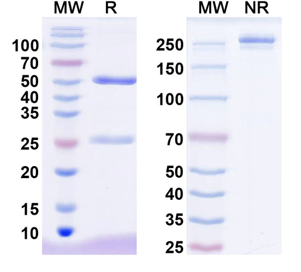 SDS-PAGE for Anti-Anti-Human DST/Dystonin antibody (SAA2231)