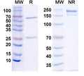 SDS-PAGE for Anti-Anti-Human DST/Dystonin antibody (SAA2232)
