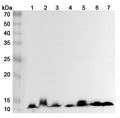 Western blot analysis was performed using anti-HBA1 polyclonal antibody at 1ug/mL on various samples.
Lane 1: Mouse heart lysate
Lane 2: Mouse liver lysate
Lane 3: Mouse spleen lysate
Lane 4: Rat heart lysate
Lane 5: Rat liver lysate
Lane 6: Rat spleen lysate
Lane 7: Rat brain lysate