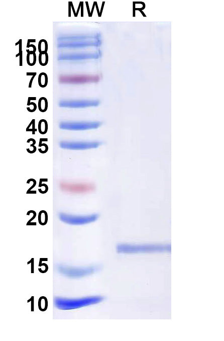 SDS-PAGE for Anti-Human CD339/JAG1 Nanobody (SAA1285)