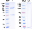 Anti-Human Claudin-18.2 Reference Antibody (Elatatug) – Figure 1 of 1
