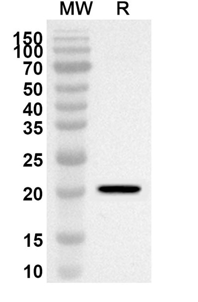 Western blot analysis was performed using anti-POU5F1/OCT3/OCT4 polyclonal antibody at 1ug/mL on recombinant POU5F1/OCT3/OCT4 (Catalog No. HX129012).
